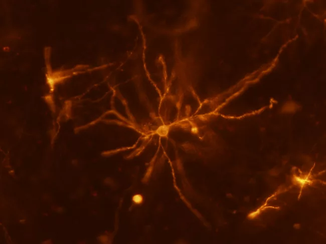 Mouse neuron.