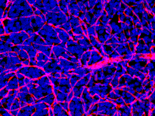 Microscopic image of the blood-brain barrier in a mouse.