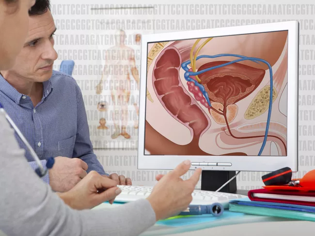Doctor shows patient anatomy image of prostate on computer.