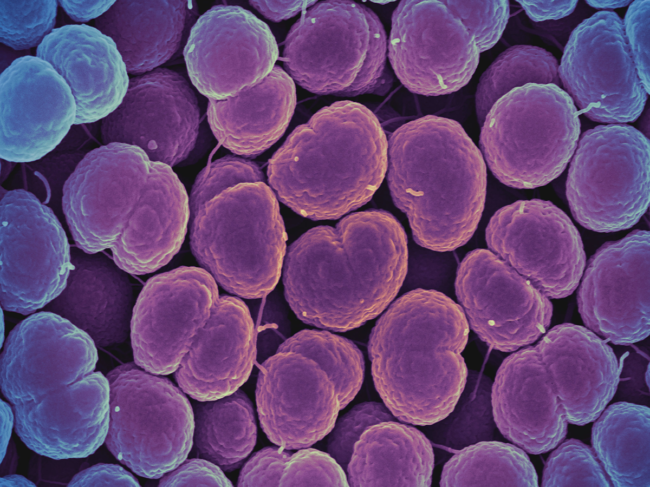 Colorized scanning electron micrograph of N. gonorrhoeae bacteria.