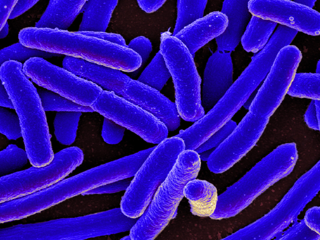 Colorized scanning electron micrograph of E. coli bacteria.