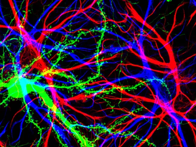 Brain cells in the hippocampus under microscope.