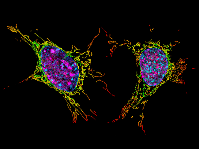 Two mouse fibroblasts image captured using structured illumination microscopy.
