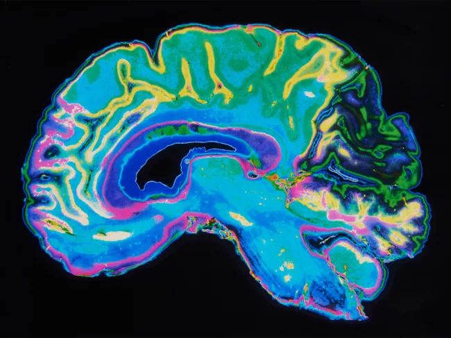 MRI image brain on black background