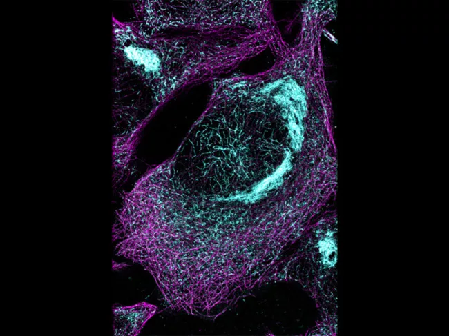 Tau protein in cell model of tauopathy