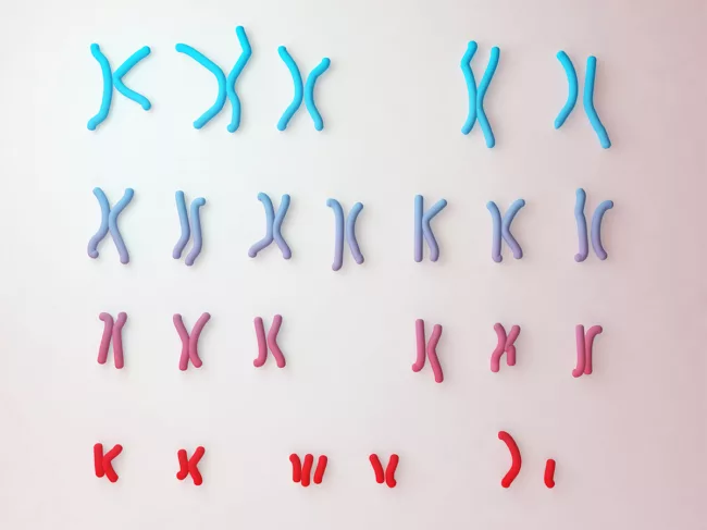 Illustration of trisomy 21 karyotype
