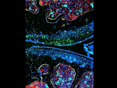 Cartilage regeneration