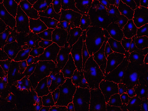 11 16 cambridge disease brain endothelial cells