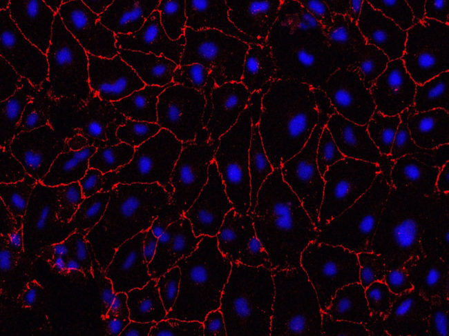Disease brain endothelial cells stained for tight junction protein