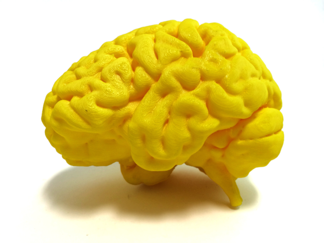 Yellow 3D-printed model of the brain