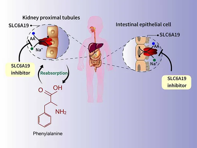 Diagram demonstrating SLC6A19 inhibitors for the treatment of phenylketonuria 