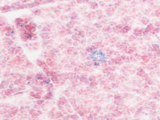Senescent cells (blue)