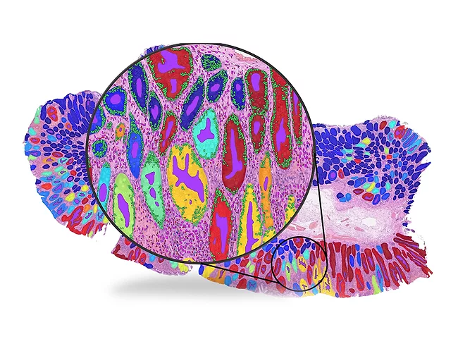 Whole slide image illustrating the detection of key histological structures such as glands and cells. 