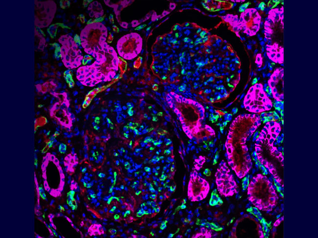 CRISPR-edited kidney under microscope