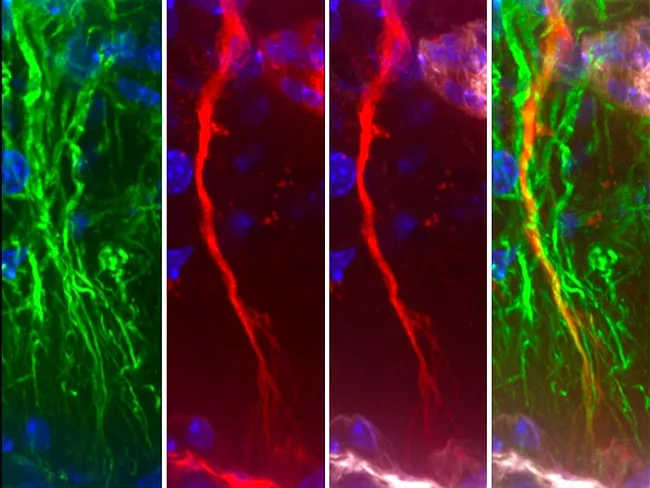 Tanycytes in green capturing tau protein in red. 