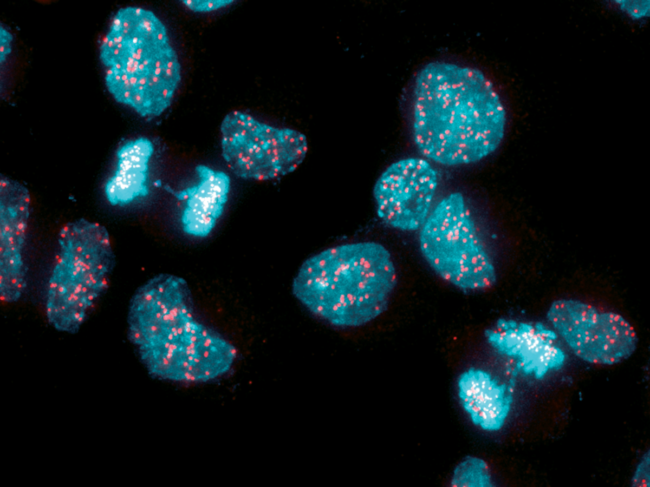 Immunofluorescence image of chromosomal instabilities