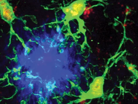 Microglia and β-amyloid-plaques
