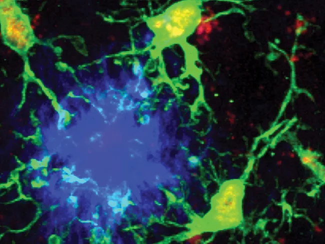 Microglia and β-amyloid-plaques