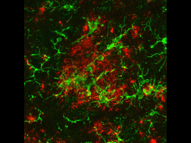 Microglia clustering around β-amyloid 