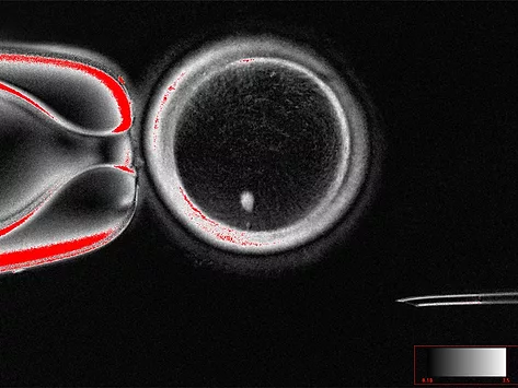 Mitalipov scnt oocyte spindle hero