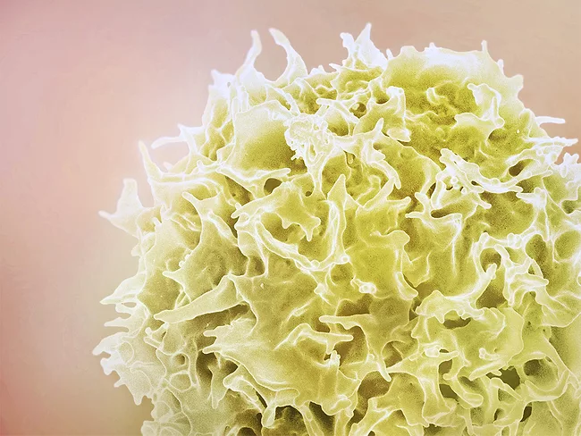 Colorized scanning electron micrograph of a T cell