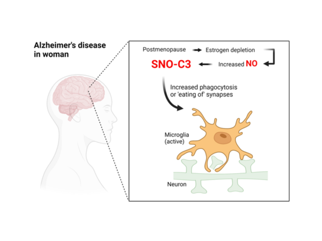 Diagram of nitrosylation in Alzheimer's