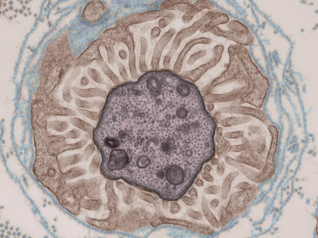 Microscopic image of nodes of Ranvier in the myelin sheath 