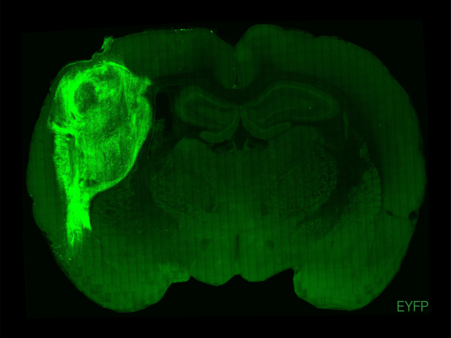 A transplanted human organoid in a section of the rat brain.