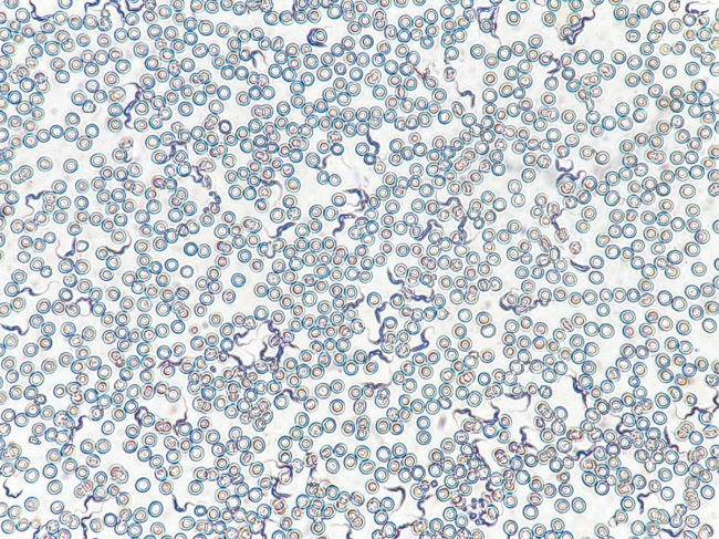 Trypanosoma brucei parasites (dark blue) among mouse blood cells (light blue and white)