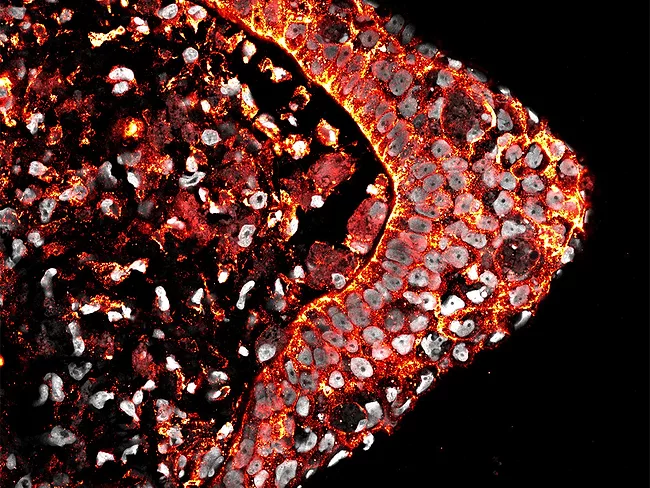 Confocal cross section of a regenerating tadpole limb. 