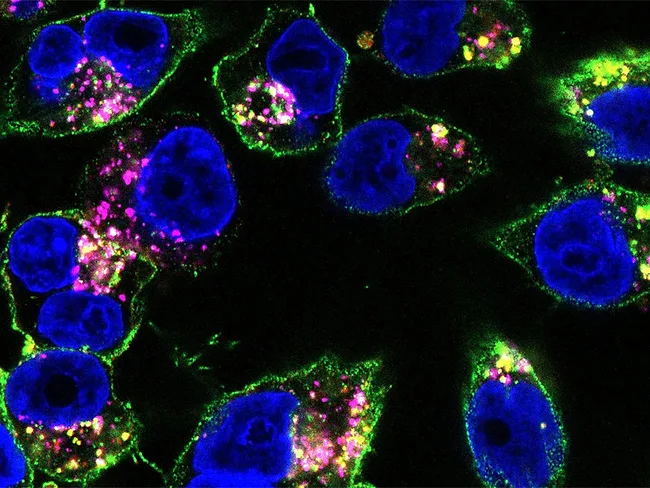 Click chemistry drug bound to pancreatic cancer cells from mice