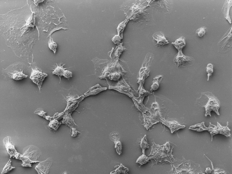 Scanning electron microscope image of cancer cells killed by programmed Photorhabdus virulence cassettes
