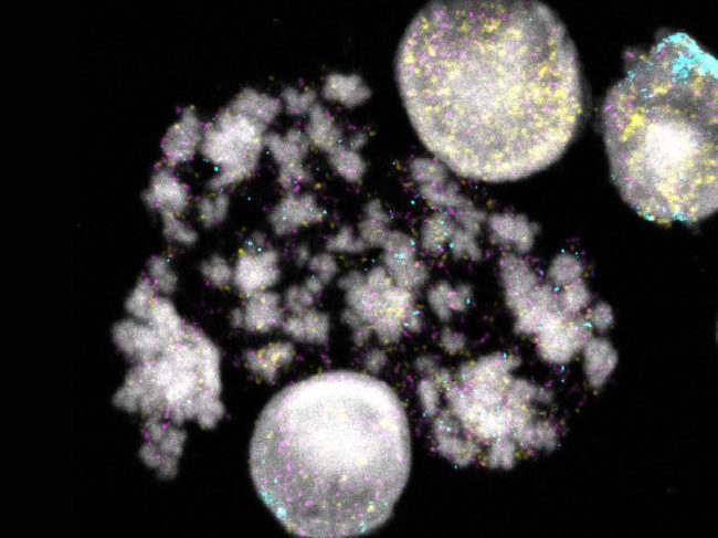 Nuclei and chromosomes of neuroblastoma cells