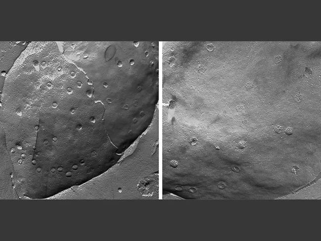 Electron microscopy images of rodent heart cell nuclei.