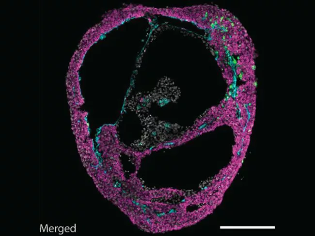 A self-organizing cardioid.