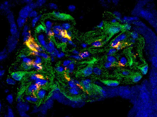 Adeno-associated virus transducing podocytes