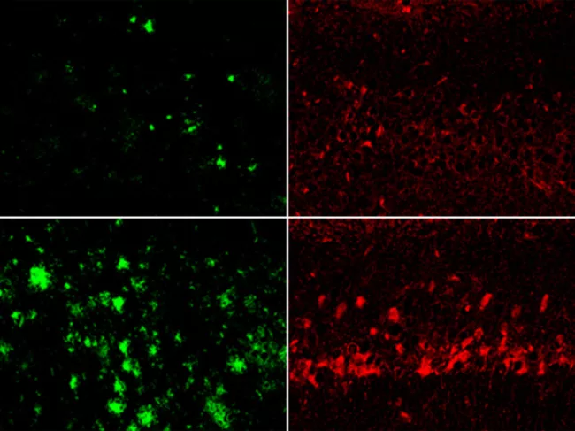 Results of lithium orotate vs. lithium carbonate on amyloid-β and tau
