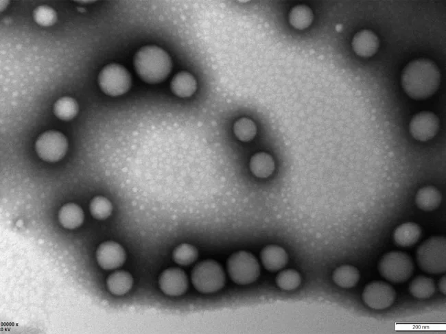 Transmission electron microscopy images of the nanoparticles.