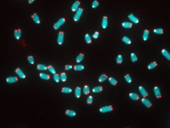 Confocal microscopy image showing chromosomes, telomeres.