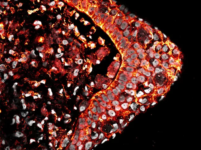 Confocal cross section of a regenerating tadpole limb. 