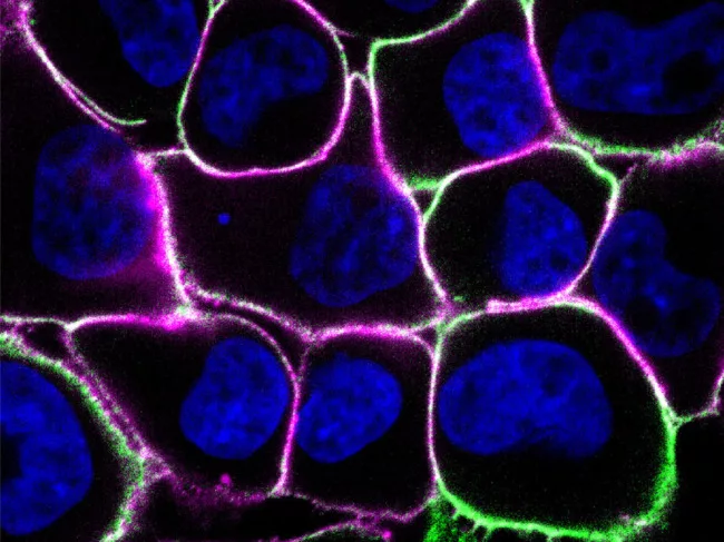 Human breast cancer cells