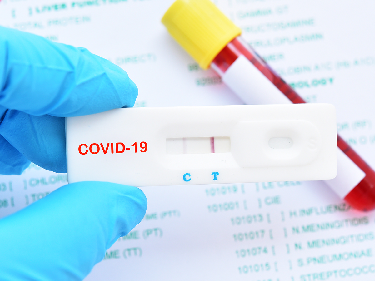 COVID 19 coronavirus diagnostic test