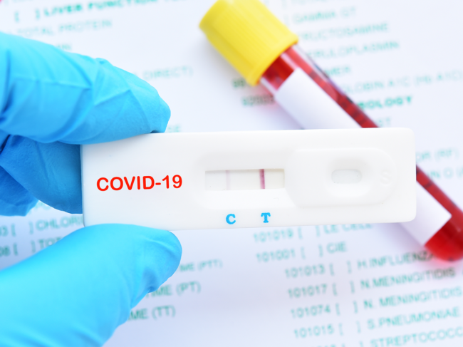 Rapid testing result for COVID-19