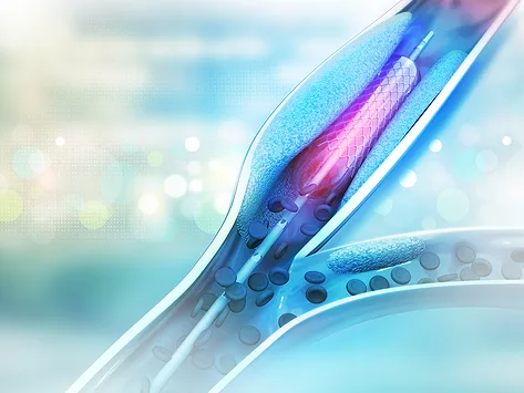 Cardiovascular stent drug eluting device