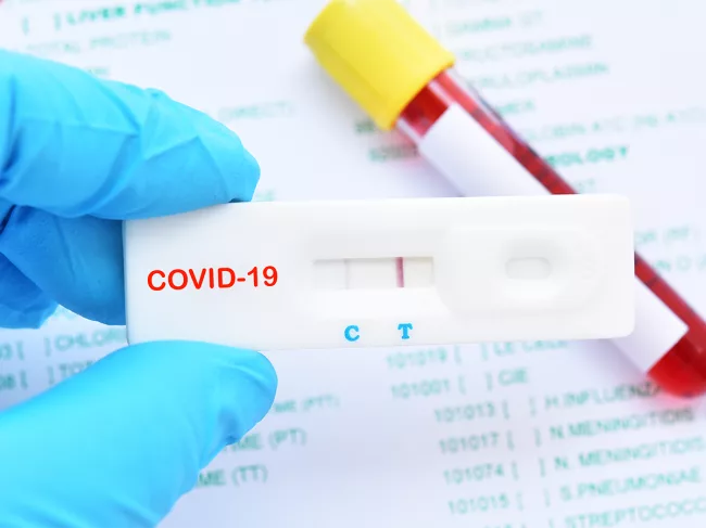Rapid testing result for COVID-19