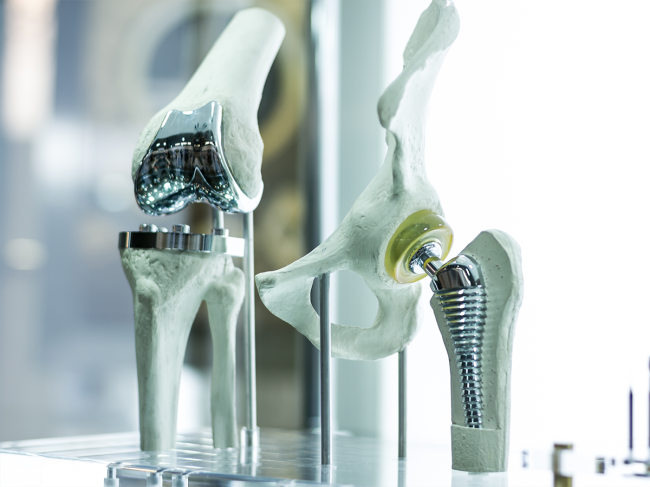 orthopedics-implant-joint-replacement.png