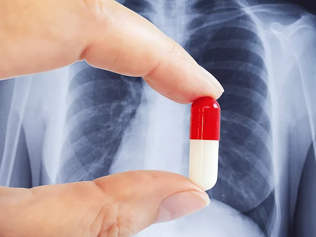 Hand holding capsule in front of chest X-ray