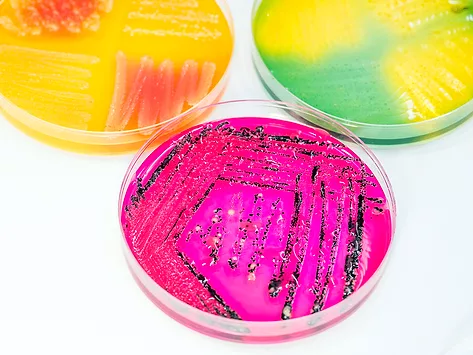 Bacterial colonies in petri dishes