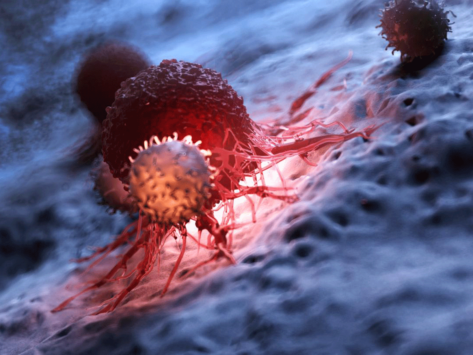 CAR T cell attacking cancer cells