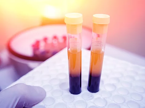 Blood sample tubes after centrifuge